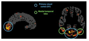 컨볼루션 신경망의 중간 변수로 활동이 유의미하게 예측되는 뇌 영역. 빨간색에서 노란색으로 갈수록 더 기계학습의 중간변수와 활동사이의 상관성이 높은 영역이며 주로 후두부에 위치하는 부분임