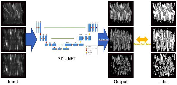 3차원 U-Net 신경망의 학습 개요