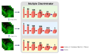감별자 신경망 구조: Multi-Patch GAN