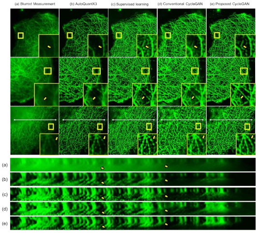 Monkey Kidney Fibroblasts 영상에 적용된 Deconvolution 기법 비교