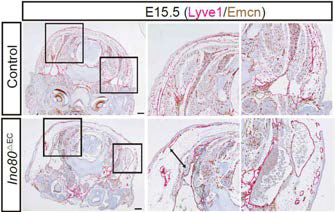 Ino80ΔEC 배아의 면역염색 (Red: 림프내피세포, Lyve1; Brown: 혈관내피세포, Emcn)