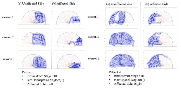 자유탐색평가에서의 Hemispatial Neglect 관찰(좌:양성, 우:음성)