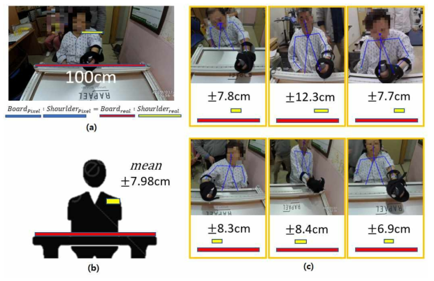 환자의 허리 및 어깨축 이동 분석 결과. (a) 이미지상에서의 어깨의 수평 변화 계산법. (b) 어깨 움직임의 평균 및 비율 에 대한 시각화 © 각 환자들의 어깨 움직임 예시