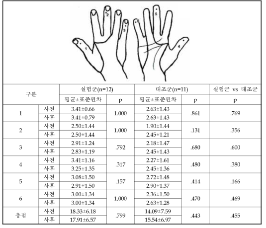 GRASSP_sensation 평가_불완전 손상 환자