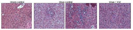 생쥐 간에서 간염에 대한 mVSF의 항바이러스 활성