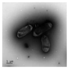 Methylocystis sp. B8의 전자 현미경 사진