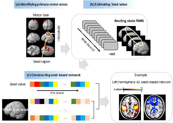 rsfMRI를 이용한 운동네트워크 분석 예시