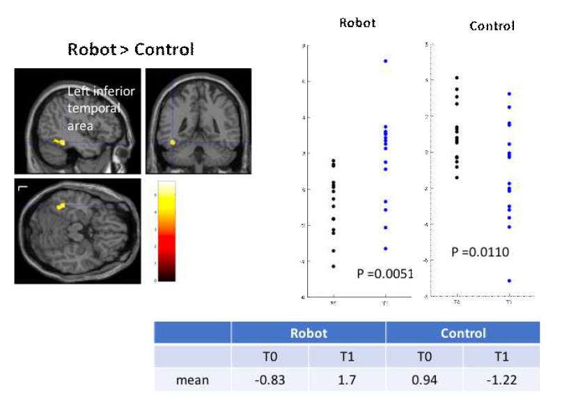 우반구 paracentral lobule이 seed 영역일 때 T1-T0 t-maps 값이 robot군과 treadmill 치료군 사이에 유의한 차이를 보이는 영역. 즉 뇌 연결성의 변화가 집단 간 차이를 보이는 뇌 영역을 관찰함