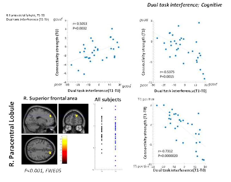 우반구 paracentral lobule이 seed 영역일 때 우반구 superior frontal area와 연결성이 증가할수록 Dual task interference가 악화