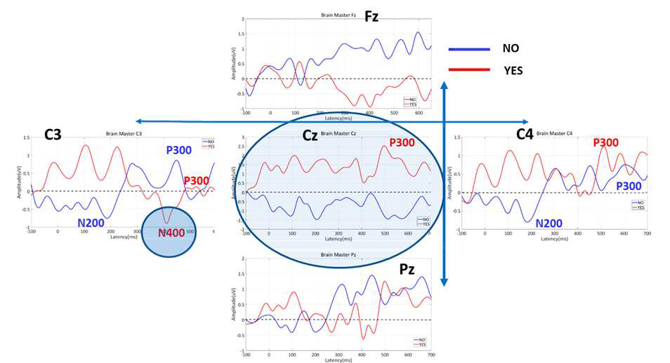 사건관련전위 분석결과 (C3, Cz, C4, Fz, Pz 에 초점)