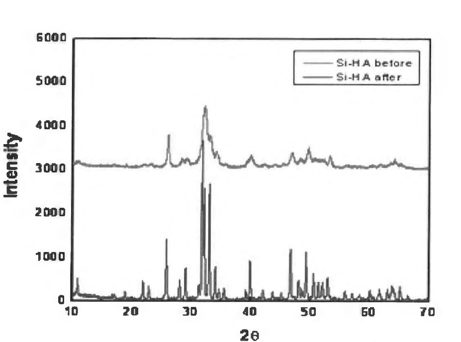 X-ray diffraction pattern of Si substituted Hydroxyapatite(Si-HA)
