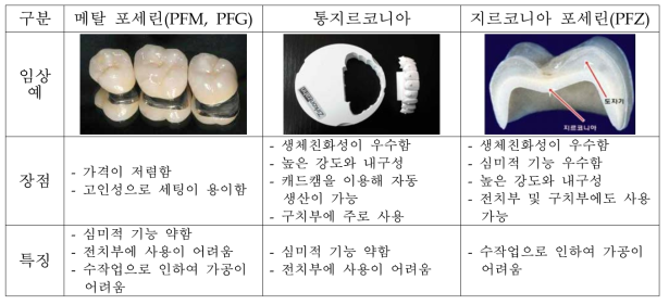 치과 보철물들의 기본 특성 비교