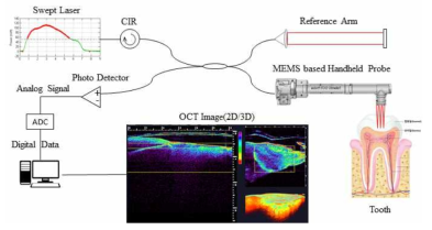 SS-OCT 시스템 구성도