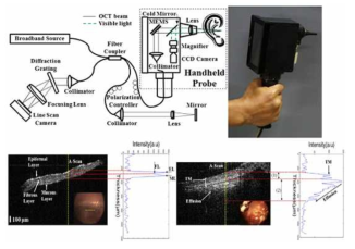 MEMS 스캐너 기반 CCD가 포함된 고막 촬영용 OCT 프로브