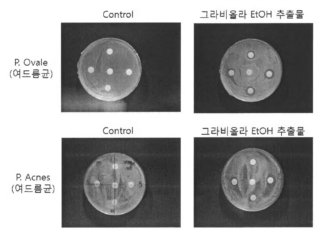 그라비올라 추출물의 여드름균 항균 효과