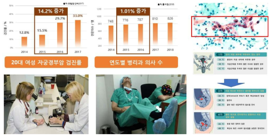 진단 수요증가에 따른 의사 수 부족으로 인한 초기 진단의 실패 및 위음성율 증가