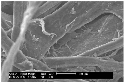 SEM pictures of American products (aged for 5 weeks)