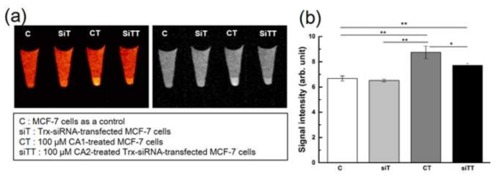 Trx 표적 MRI T1 조영제를 처리한 MCF-7 세포 및 Trx-siRNA 로 형질 전환된 MCF-7 세포에서의 MR 팬텀 이미지