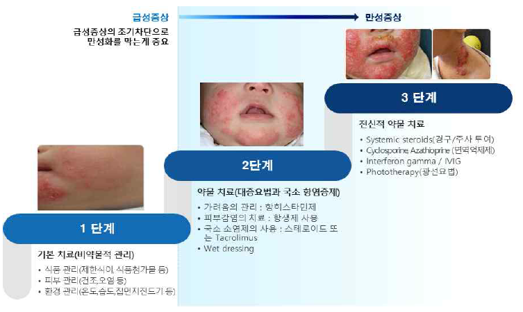 아토피피부염 단계별 치료 방법