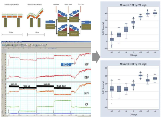 체위변화에 따른 혈압, 뇌관류혈압, 뇌내압력 변화