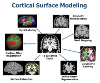 Cortical Surface Model