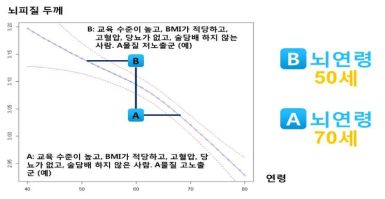 뇌 영상 결과 분석 예시