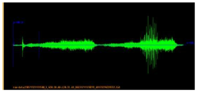 Abnormal signal(right) compared to normal signal (left) measured from vehicle steering system