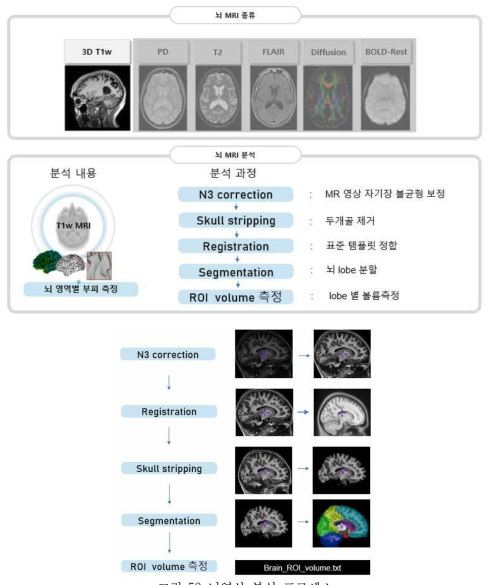 뇌영상 분석 프로세스