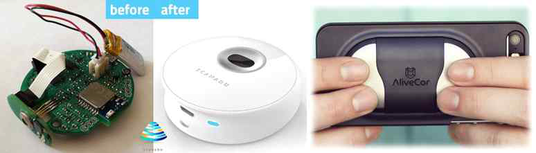 Scanadu 社의 Scout(좌) 와 AliveCor 社의 개인용 심전도 측정기