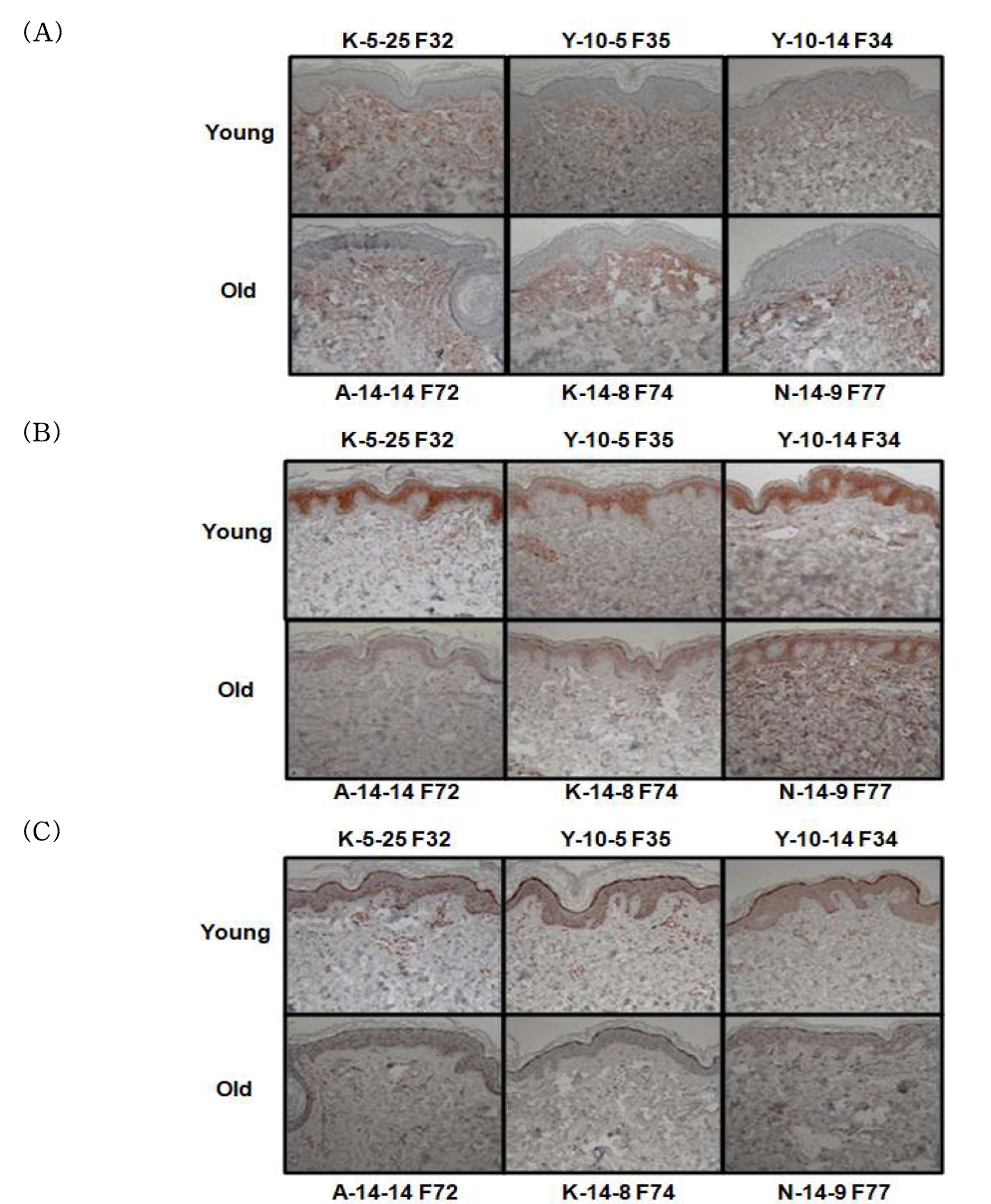 자연 노화 인체 모델의 피부 조직에서 표적 유전자 후보들의 IHC 분석