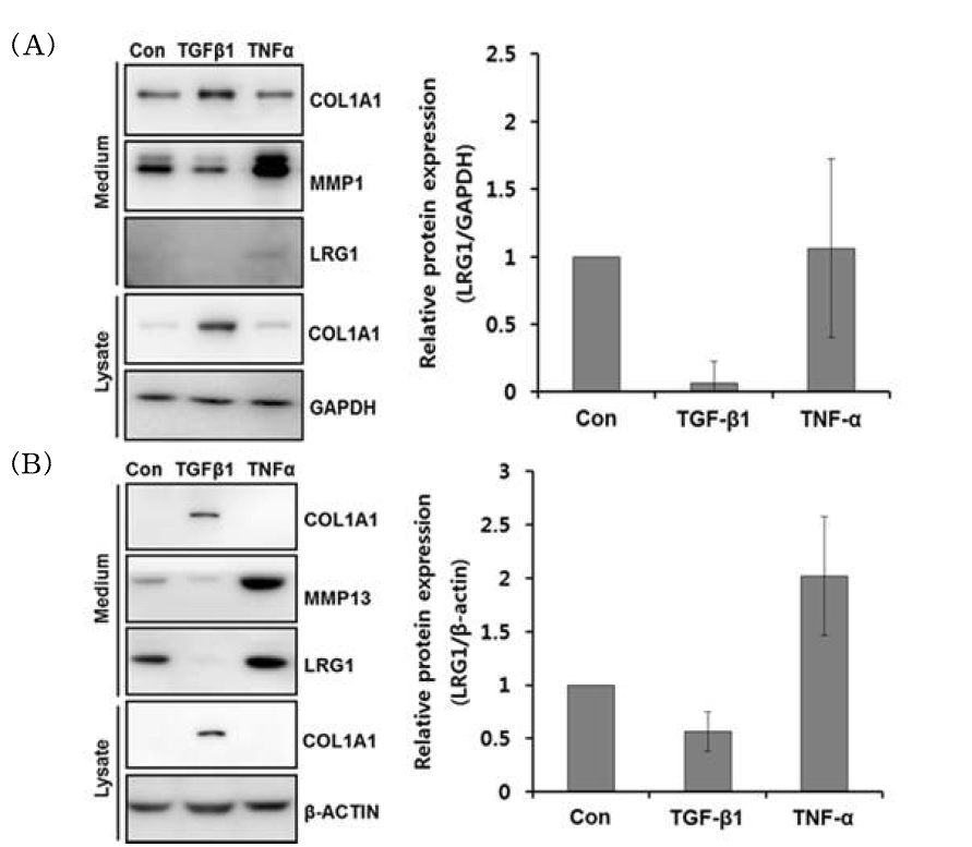 TGF-β1과 TNF-α 에 의한 LRG1 발현 변화 분석