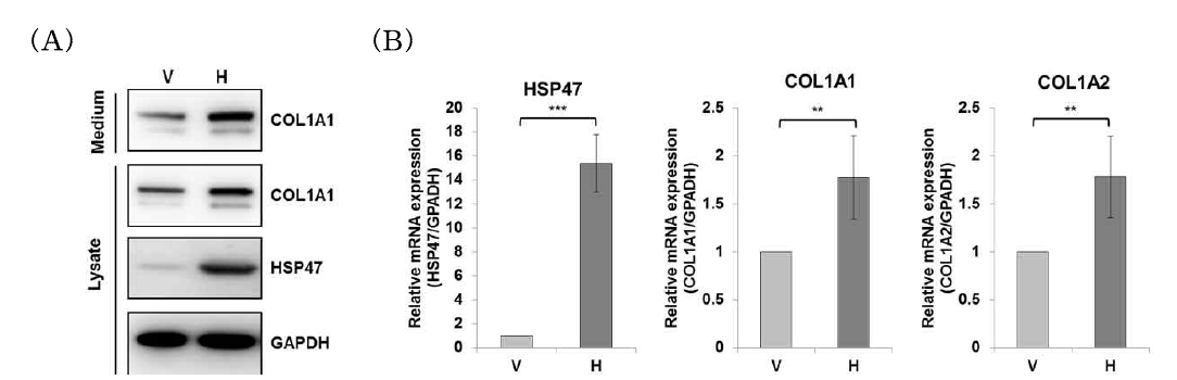 인체 포피 섬유아세포에서 HSP47에 의한 type I collagen 발현 분석