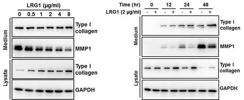 사람 진피 섬유아세포에서 LRG1에 의한 type I collagen과 MMP-1 발현 분석