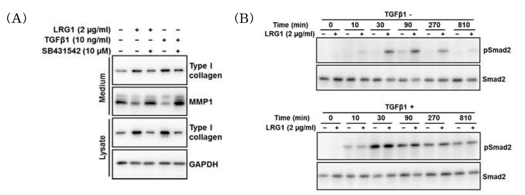 젊은 사람 유래의 섬유아세포에서 LRG1에 의한 type I collagen 생성 촉진 및 MMP-1 분비 감소 기전 분석