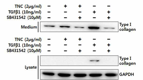 사람 포피 섬유아세포에서 TNC에 의한 type I collagen 생성 분석