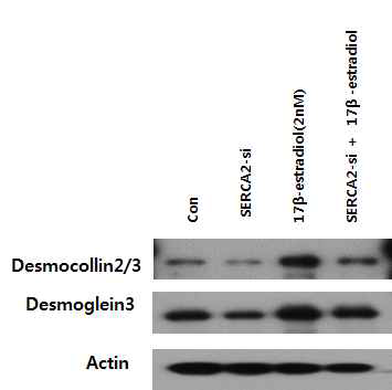 표피세포에서 SERCA2 감소에 의한 결합체 발현감소가 17β-estradiol에 의해 억제됨