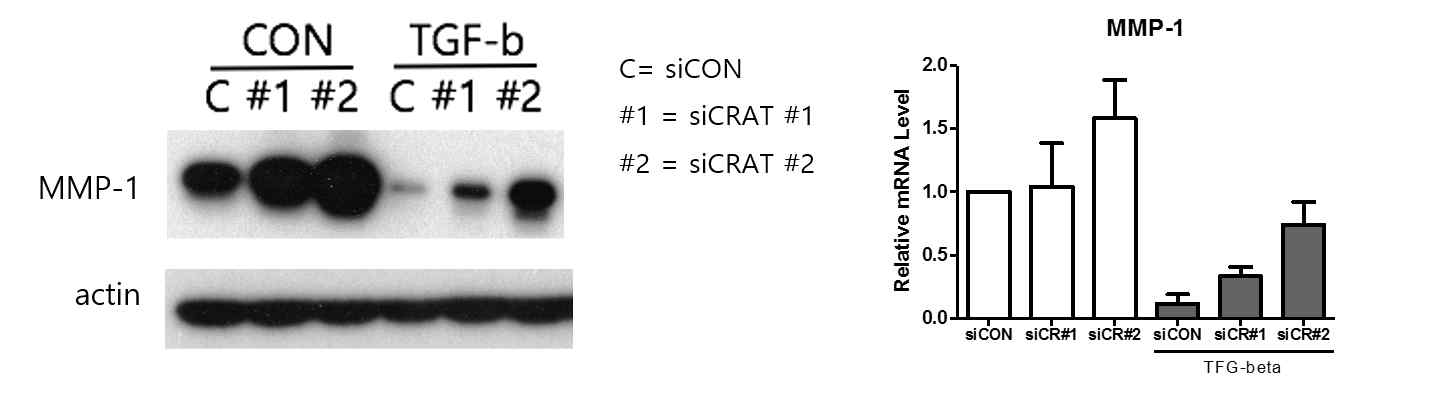 CRAT 감소에 의한 MMP-1의 증가에 TGF-β signaling이 관여함