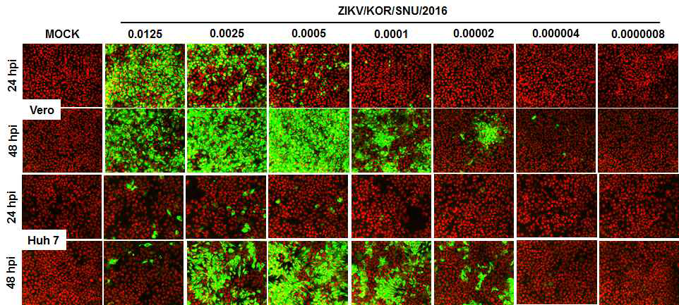 ZIKV 감염 조건 테스트
