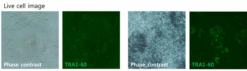TRA1-60를 이용하여 역분화 초기 콜로니를 염색하여 live cell image 확인