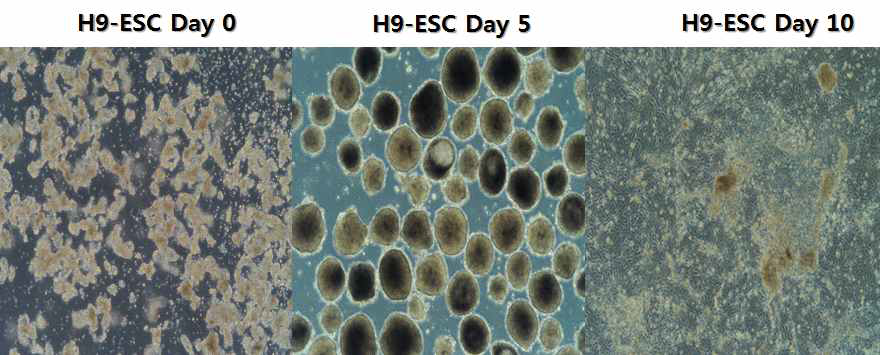 hESC-H9을 이용하여 자연분화 (EB)를 형성하여 분화 시기 별로 확인