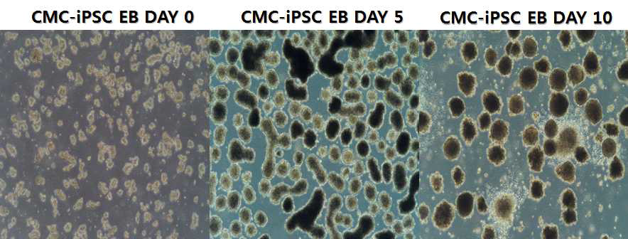 hiPSC-CMC3을 이용하여 자연분화 (EB)를 형성하여 분화 시기 별로 확인