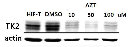 TK2 inhibitor 처리에 대한 TK2 발현 감소 확인