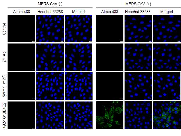 MERS-CoV 감염 세포와 비감염 세포에서의 Spike-492-1G10E4E2 단일클론항체의 바이러스 인식능 확인
