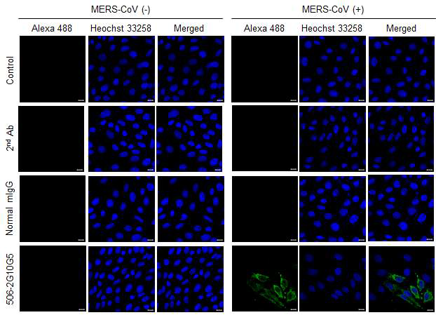 MERS-CoV 감염 세포와 비감염 세포에서의 506-2G10G5 단일클론항체의 바이러스 인식능 확인