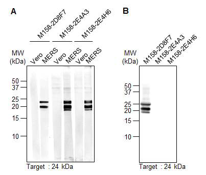 MERS-CoV-M158 에피톱-특이적인 클론들의 세포배양액의 MERS-CoV M protein 인식 확인. (A) Western blotting. (B) Immunoprecipitation