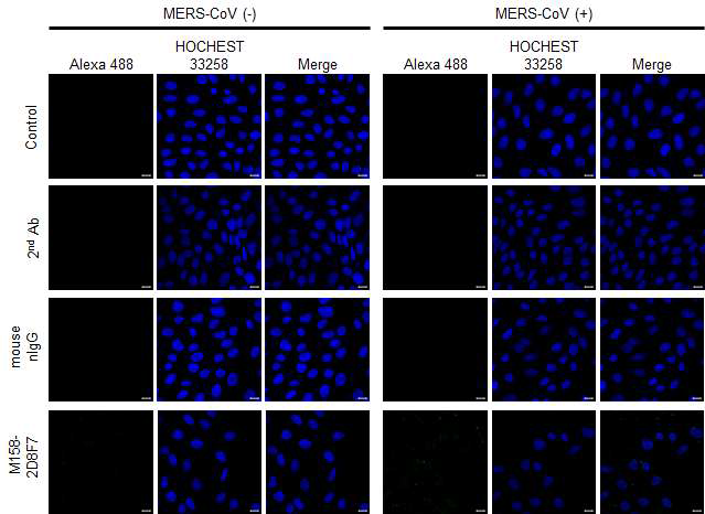 MERS-CoV 감염 세포와 비감염 세포에서의 M158-2D8F7 단일클론항체의 바이러스 인식능 확인