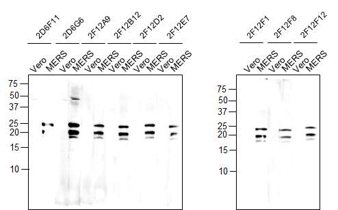 MERS-CoV-M158 에피톱-특이적인 클론들의 세포배양액의 MERS-CoV M protein 인식 확인. (A) Western blotting. (B) Immunoprecipitation