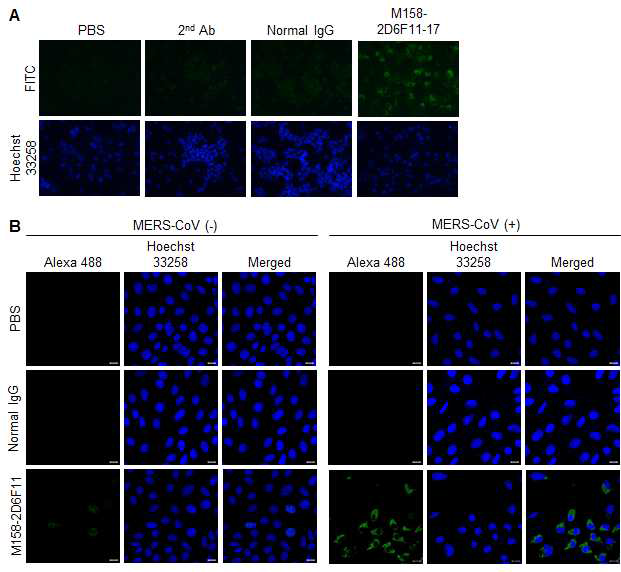 M158-2D6F11 단일클론항체의 MERS-CoV M protein 인식능 확인. (A) IFA. (B) Confocal images