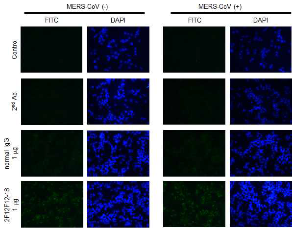 M158-2F12F12 단일클론항체의 MERS-CoV M protein 인식능 확인 (IFA)