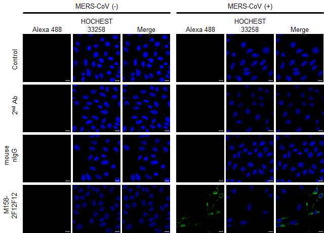 M158-2F12F12 단일클론항체의 MERS-CoV M protein 인식능 확인. Confocal images